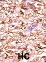 Anti-Phospho-p53 (T18) Antibody