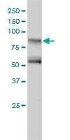 Anti-GIT2 Antibody