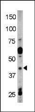 Anti-Phospho-RAD9 (Y28) Antibody