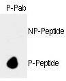 Anti-Phospho-Rb (S788) Antibody