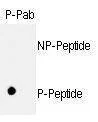 Anti-Phospho-Rb (S811) Antibody