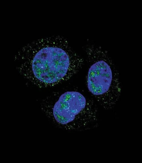 Anti-Phospho-Rb (S811) Antibody