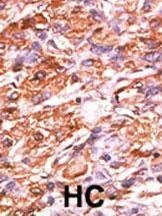 Anti-Phospho-Rb (S811) Antibody