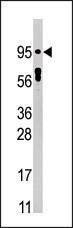 Anti-Phospho-STAT5a (Y694) Antibody