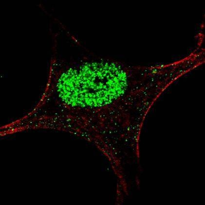 Anti-Phospho-STAT5a (Y694) Antibody
