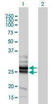 Anti-GJB4 Antibody