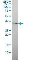 Anti-GJB4 Antibody