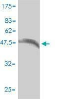 Anti-GJB4 Antibody