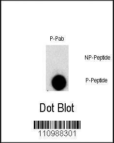 Anti-Phospho-FGFR1 (Y307) Antibody