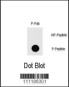 Anti-Phospho-MEF2C (T20) Antibody