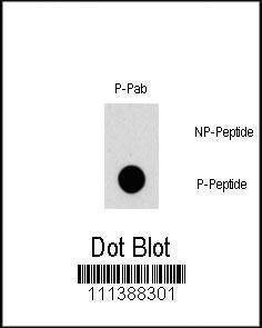 Anti-Phospho-TSC2 (S1387) Antibody