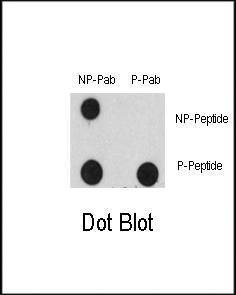 Anti-Phospho-EGFR (Y1125) Antibody
