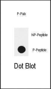 Anti-Phospho-EGFR (Y1172) Antibody