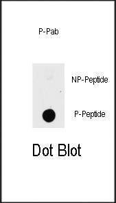 Anti-Phospho-PAK1 (T423) Antibody