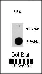 Anti-Phospho-TSC2 (S939) Antibody