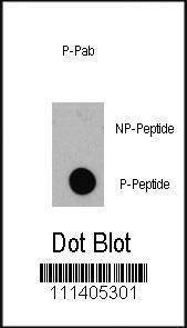 Anti-Phospho-EIF4EBP1 (T36) Antibody