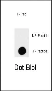 Anti-Phospho-TSC2 (S664) Antibody