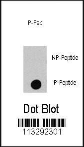 Anti-Phospho-RAF1 (S494) Antibody