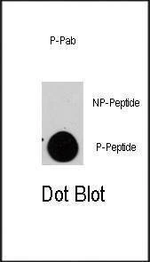 Anti-Phospho-TSC2 (S1798) Antibody