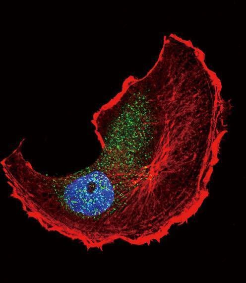 Anti-Phospho-TSC2 (S1798) Antibody