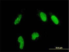 Anti-GLTSCR2 Antibody