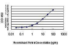 Anti-GLTSCR2 Antibody