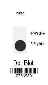 Anti-Phospho-MDM2 (T218) Antibody