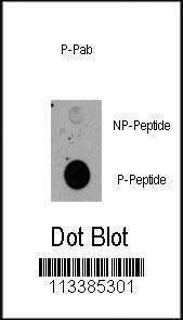 Anti-Phospho-RPS6KA1 (T359) Antibody