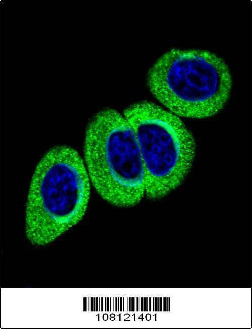 Anti-Phospho-ATM (S1981) Antibody