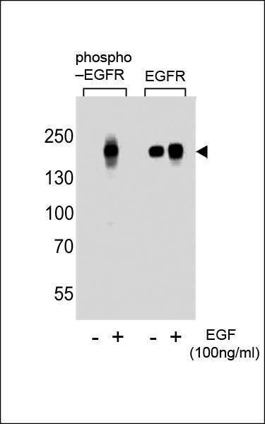 Anti-Phospho-EGFR (S768) Antibody