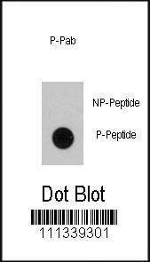 Anti-Phospho-RAF1 (S339) Antibody