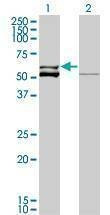 Anti-GLUD2 Antibody