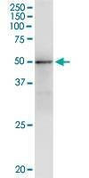 Anti-GMPPA Antibody