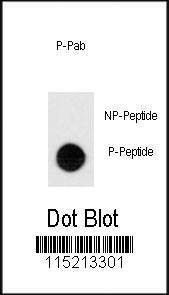 Anti-Phospho-TEK (Y1113) Antibody