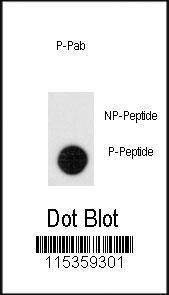 Anti-Phospho-Leo1 (S551) Antibody