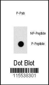 Anti-Phospho-OSR1 (T310) Antibody