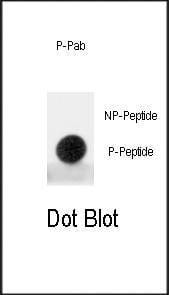 Anti-Phospho-MDM2 (S395) Antibody