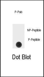 Anti-Phospho-SPRY4 (Y75) Antibody
