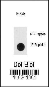 Anti-Phospho-NSE (Y236) Antibody