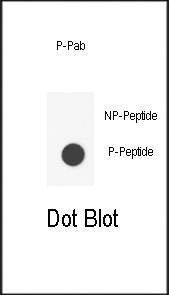 Anti-Phospho-IL6ST (Y905) Antibody