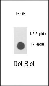 Anti-Phospho-ILK (S343) Antibody