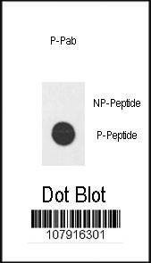 Anti-Phospho-E2F1 (H357) Antibody