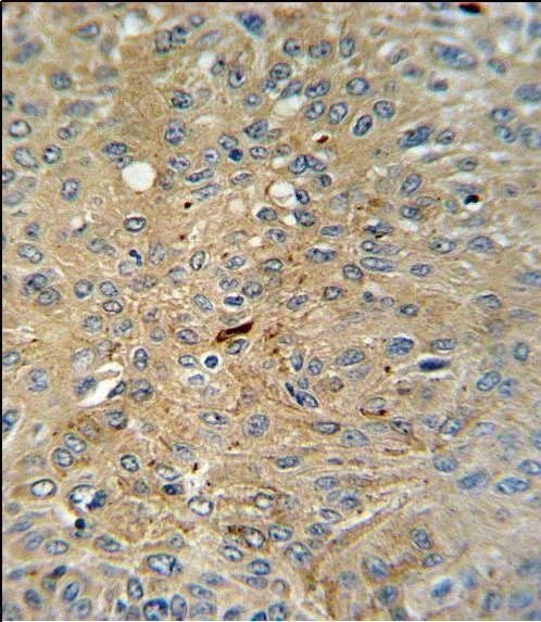 Anti-Cleaved-CASP3 (Asp175) Antibody