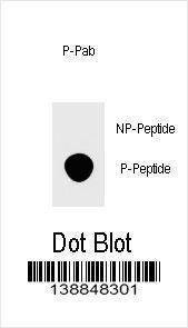 Anti-Phospho-FOXP3 (S418) Antibody