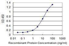 Anti-GNL3 Antibody