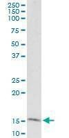 Anti-GOLGA7 Antibody