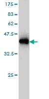 Anti-GOLGA7 Antibody