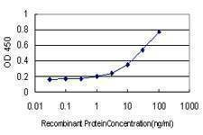 Anti-GOLGA7 Antibody