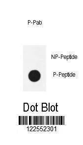 Anti-Phospho-NF kappa B (S536) Antibody