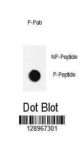 Anti-Bi-Phospho-JNK1 (T183/Y185) Antibody